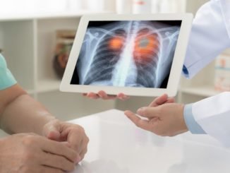 akciger kanseri nedir belirtileri ve tedavi yontemleri