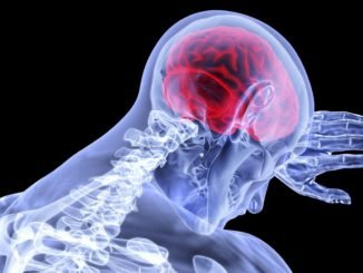 beyin sisi nedir beyin sisi baska hastaliklarin habercisi olabilir mi beyin sisi tedavisi