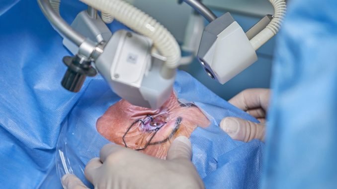 katarakt nedir katarakt nedenleri belirtileri ve tedavisi katarakt nedir katarakt nedenleri belirtileri ve tedavisi