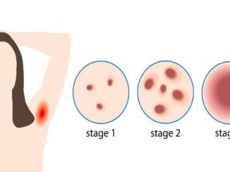 kopek memesi hastaliginin tedavisinde yuz guldurucu sonuclar